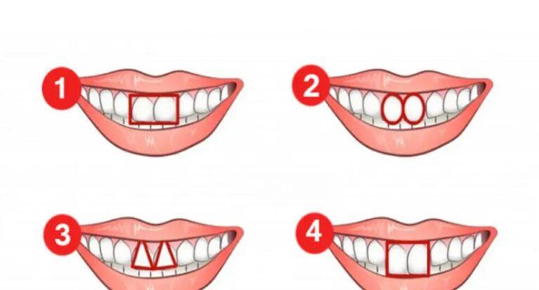 Conoce tu verdadera personalidad, según la forma de tus dientes