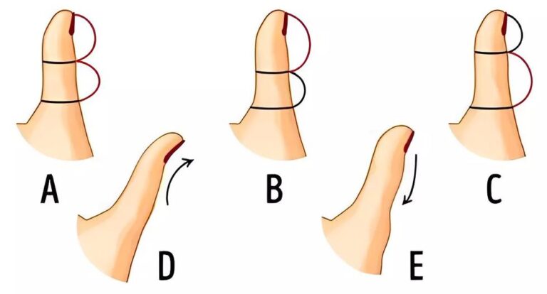 La forma de tu pulgar revelará cómo piensas y qué tipo de persona eres.